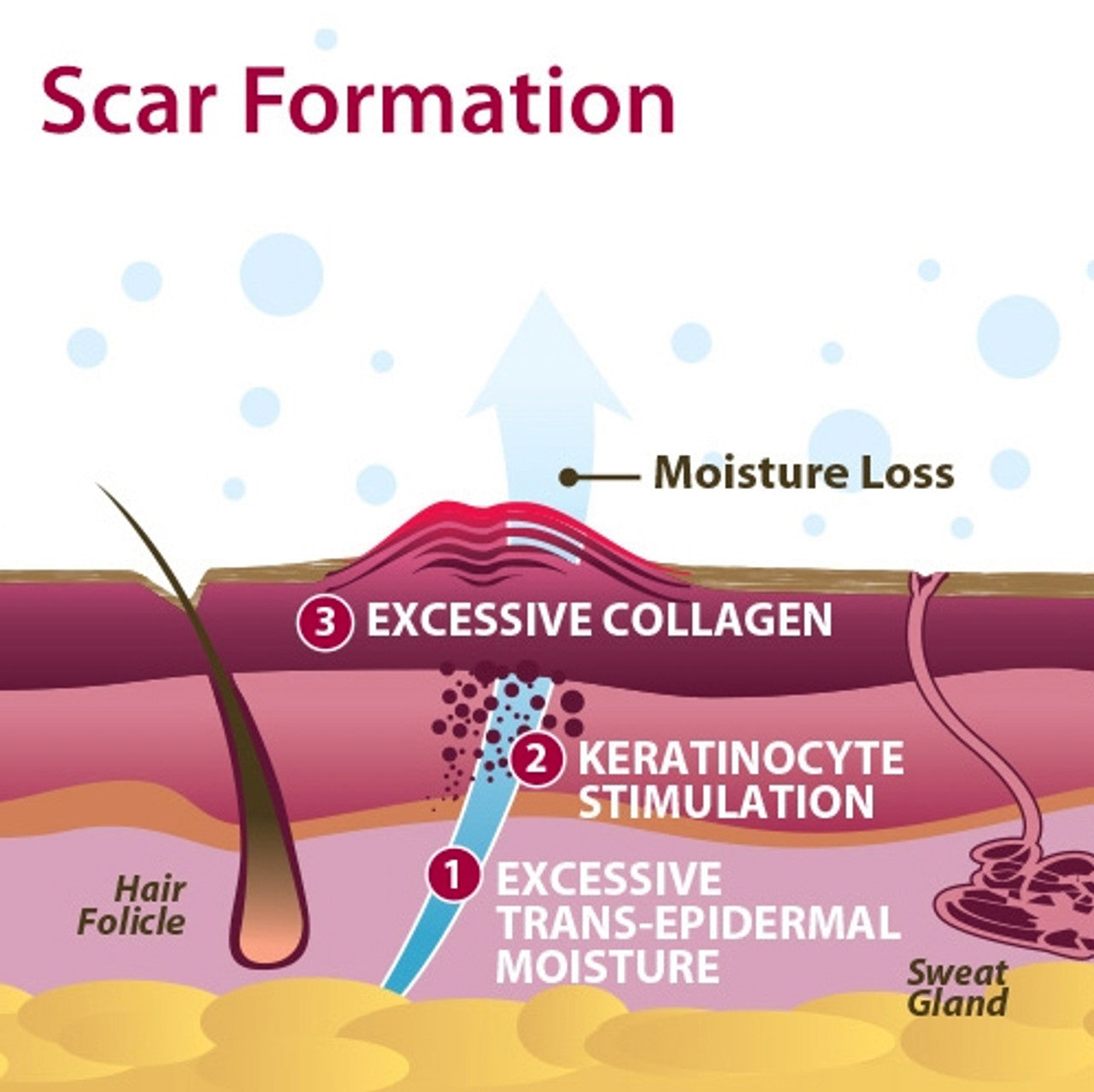 Epi-Derm Gel Areola Circles