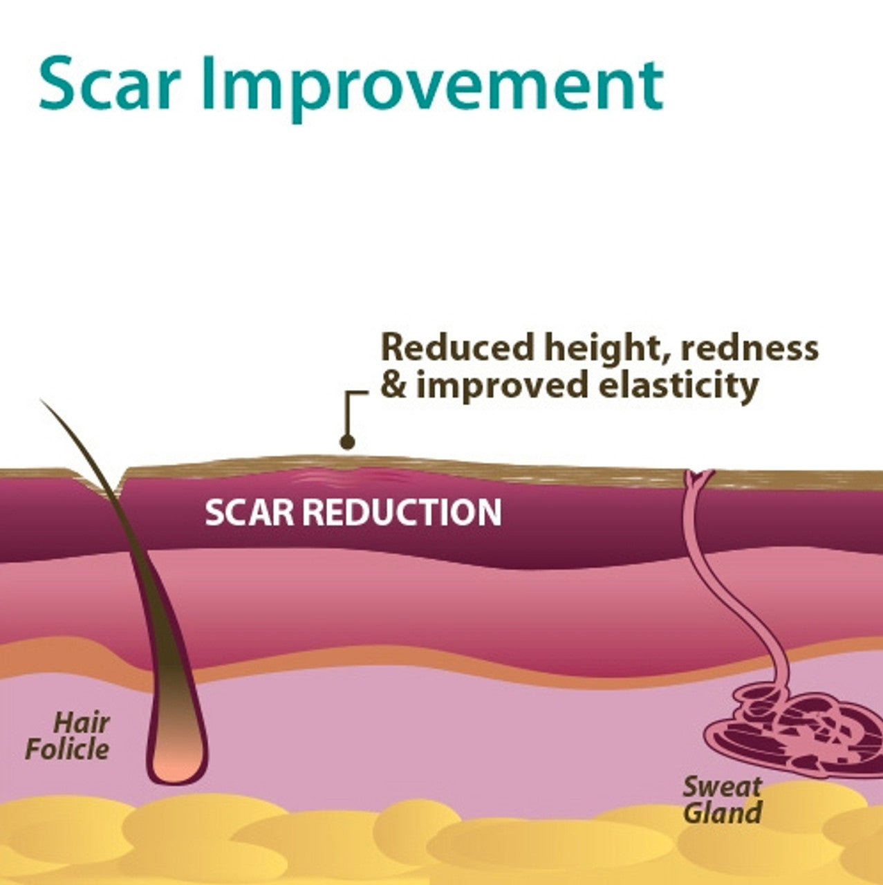 Graphic of how silicone improves scars