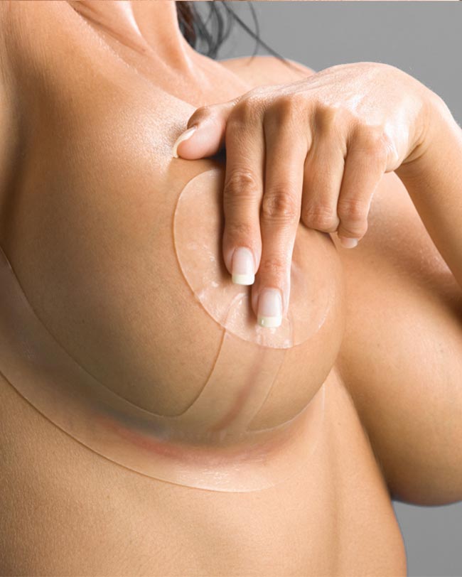Woman applying silicone to breast lift scars