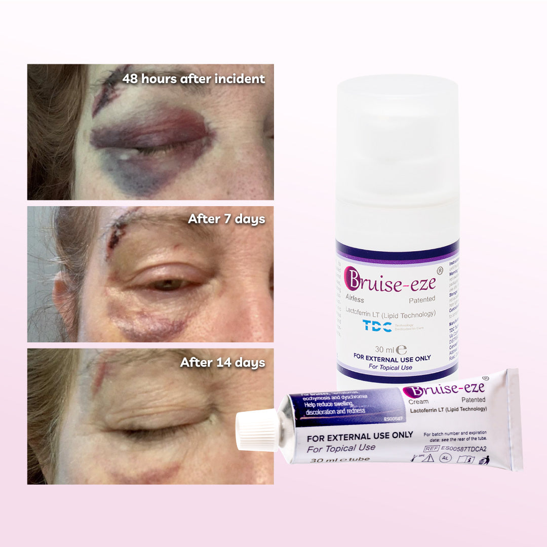 Bruise-eze Airless 30ml
